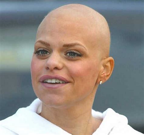 Jade Goody .